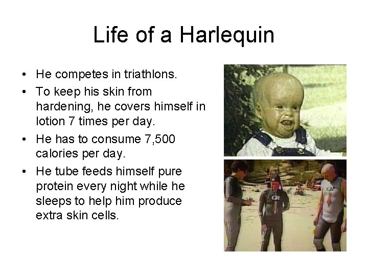 Life of a Harlequin • He competes in triathlons. • To keep his skin