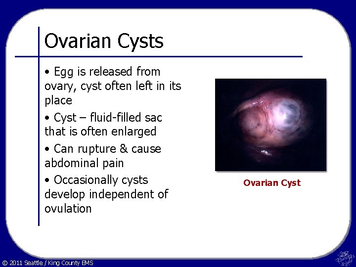 Ovarian Cysts • Egg is released from ovary, cyst often left in its place
