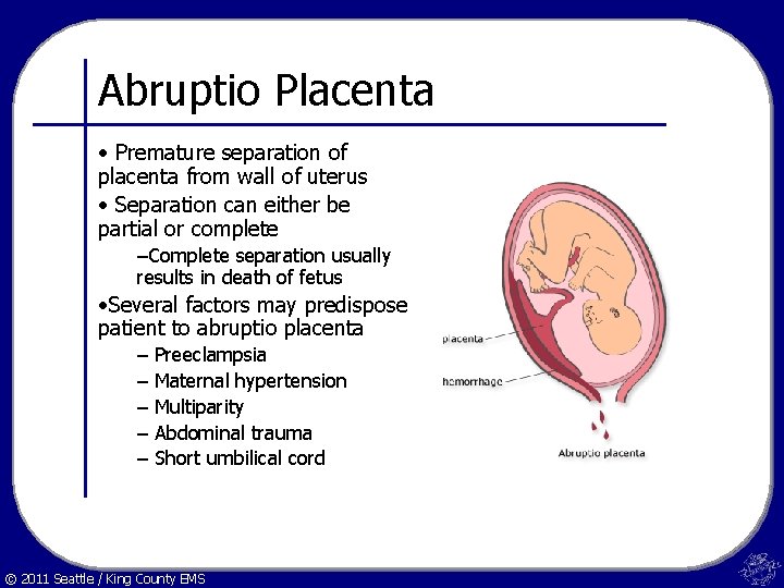 Abruptio Placenta • Premature separation of placenta from wall of uterus • Separation can