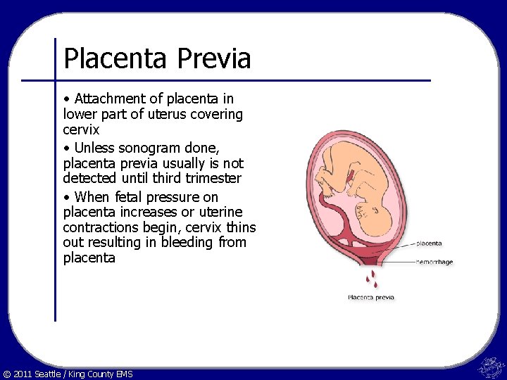 Placenta Previa • Attachment of placenta in lower part of uterus covering cervix •