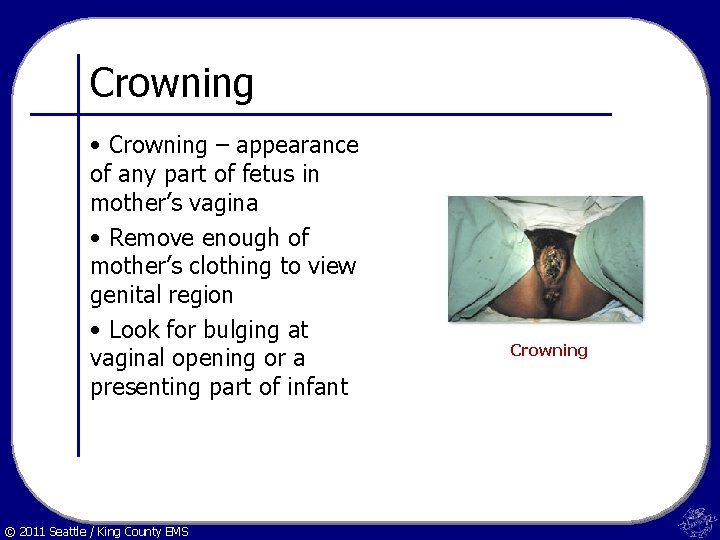 Crowning • Crowning – appearance of any part of fetus in mother’s vagina •