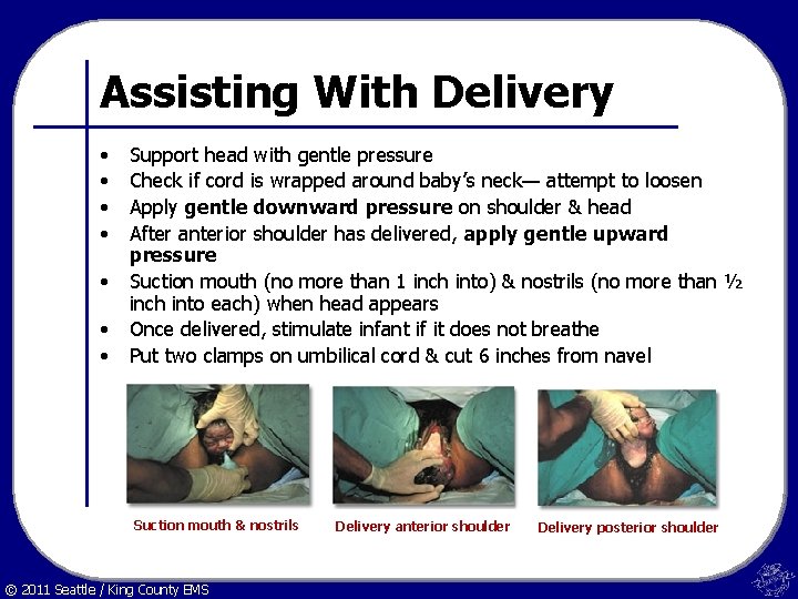 Assisting With Delivery • • Support head with gentle pressure Check if cord is