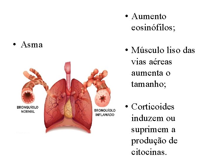  • Aumento eosinófilos; • Asma • Músculo liso das vias aéreas aumenta o