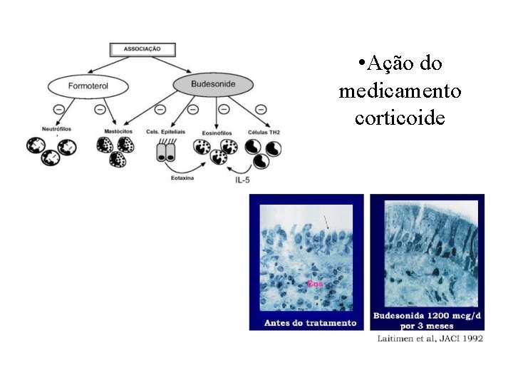  • Ação do medicamento corticoide 