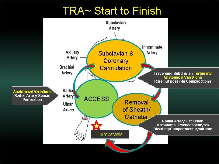 TRA~ Start to Finish Subclavian & Coronary Cannulation Anatomical Variations Radial Artery Spasm Perforation