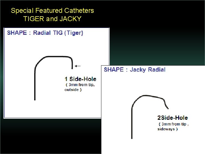 Special Featured Catheters TIGER and JACKY 