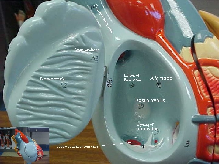 Su or i per ava ac ven Crista terminalis Pectinate muscle Limbus of fossa