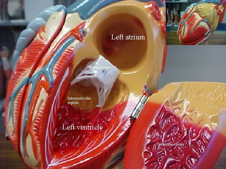 Left atrium Bicuspid valve Interventricular septum Left ventricle Trabeculae carnea 