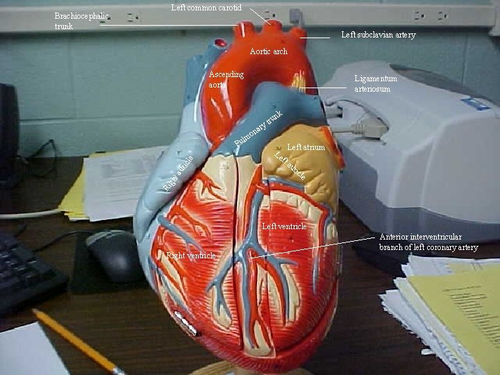 Left common carotid Left subclavian artery Aortic arch Ascending aorta Ligamentum arteriosum k run