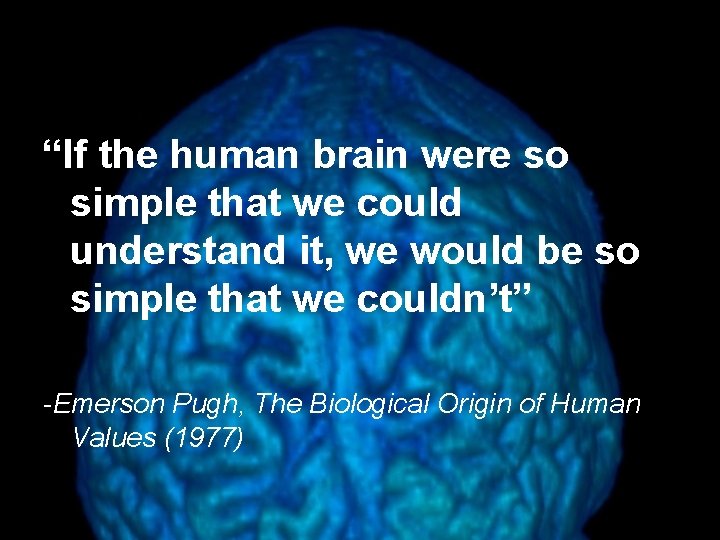 “If the human brain were so simple that we could understand it, we would