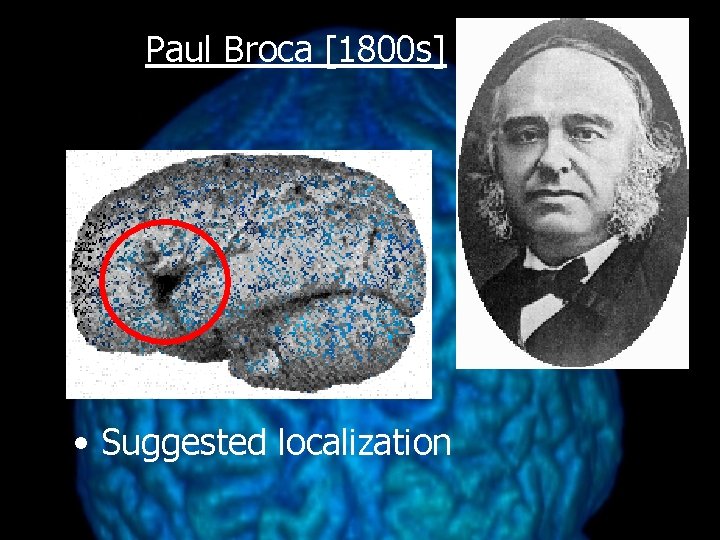 Paul Broca [1800 s] • Suggested localization 