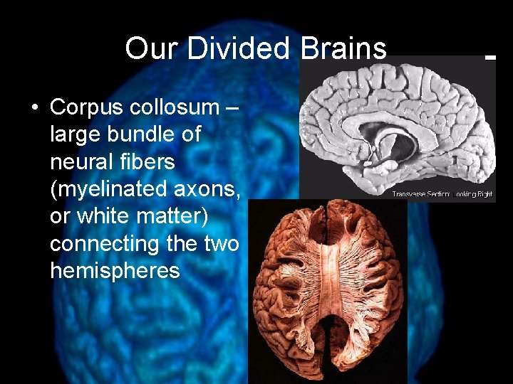Our Divided Brains • Corpus collosum – large bundle of neural fibers (myelinated axons,