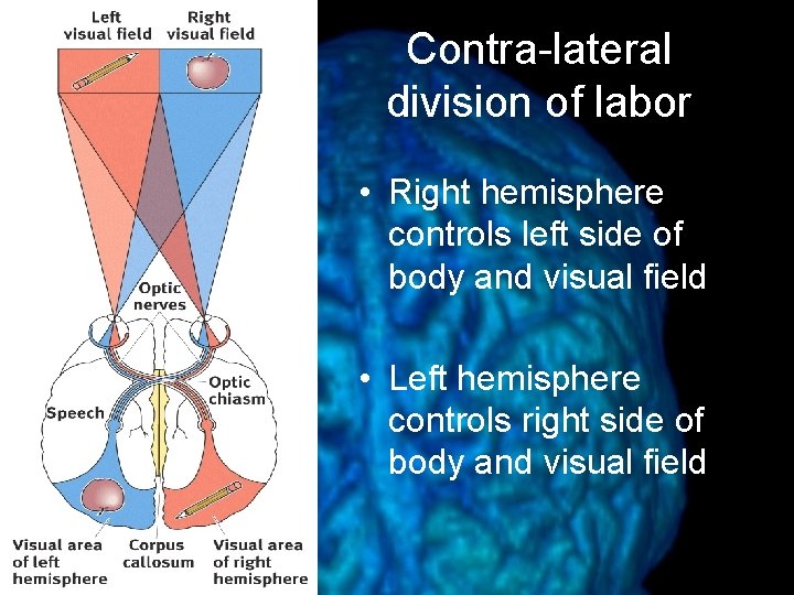 Contra-lateral division of labor • Right hemisphere controls left side of body and visual