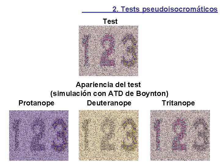 2. Tests pseudoisocromáticos Test Apariencia del test (simulación con ATD de Boynton) Protanope Deuteranope
