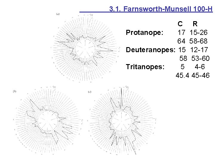 3. 1. Farnsworth-Munsell 100 -H C R Protanope: 17 15 -26 64 58 -68