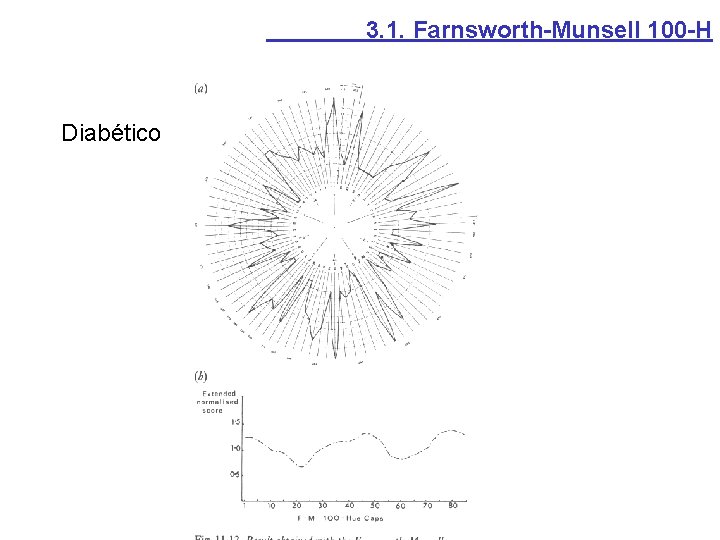 3. 1. Farnsworth-Munsell 100 -H Diabético 