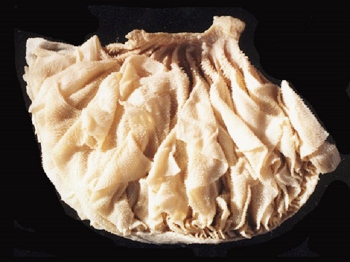. Omasum Many folds l Its Job: REDUCE l l Reduces particle size l . Omasum Many folds l Its Job: REDUCE l l Reduces particle size l