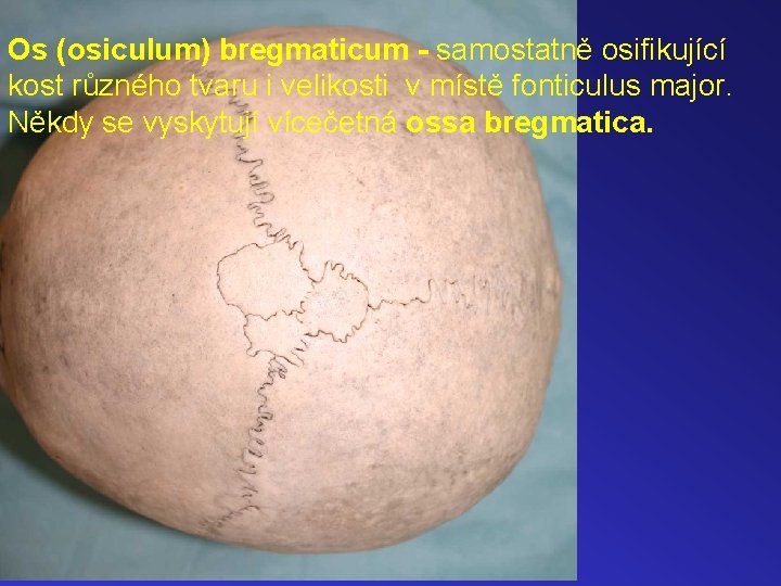 Os (osiculum) bregmaticum - samostatně osifikující kost různého tvaru i velikosti v místě fonticulus