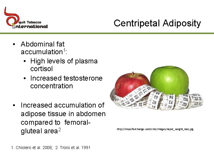 Centripetal Adiposity • Abdominal fat accumulation 1: • High levels of plasma cortisol •