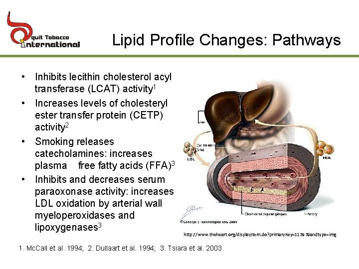 Lipid Profile Changes: Pathways • Inhibits lecithin cholesterol acyl transferase (LCAT) activity 1 •