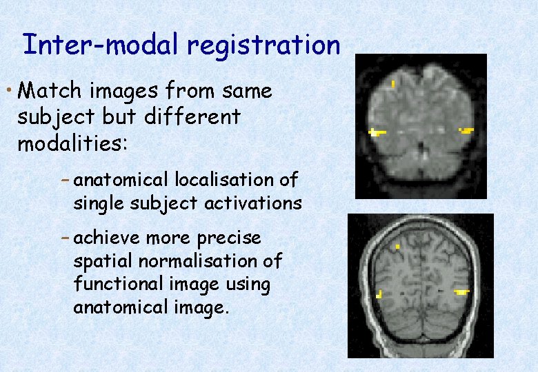 Inter-modal registration • Match images from same subject but different modalities: – anatomical localisation