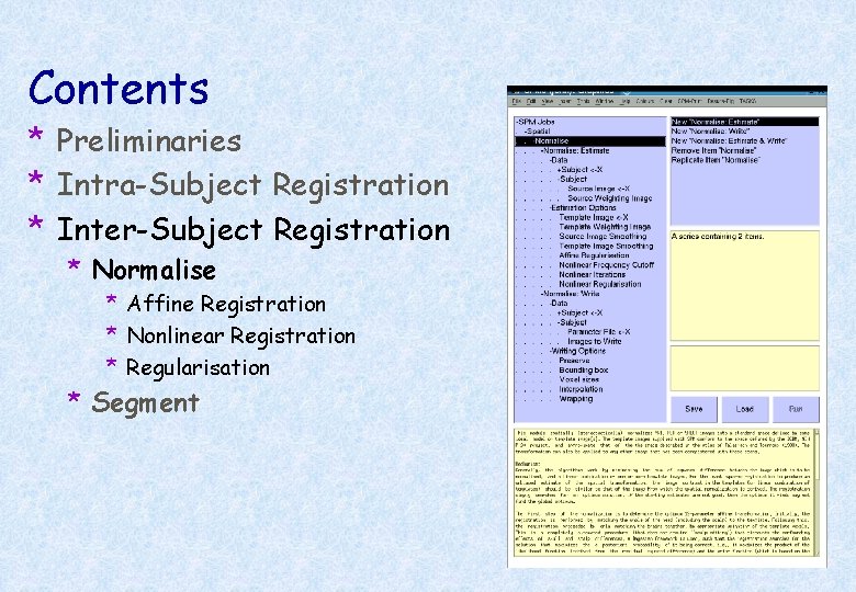 Contents * Preliminaries * Intra-Subject Registration * Inter-Subject Registration * Normalise * Affine Registration