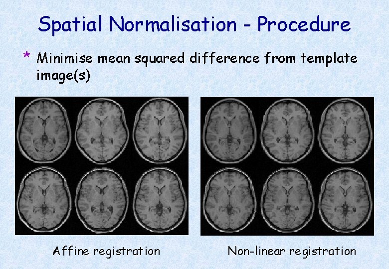 Spatial Normalisation - Procedure * Minimise mean squared difference from template image(s) Affine registration