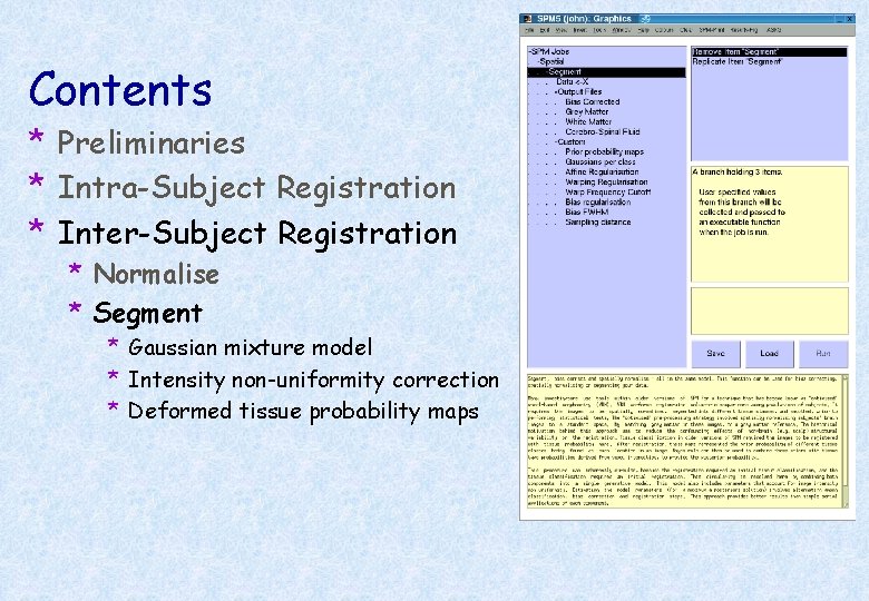 Contents * Preliminaries * Intra-Subject Registration * Inter-Subject Registration * Normalise * Segment *