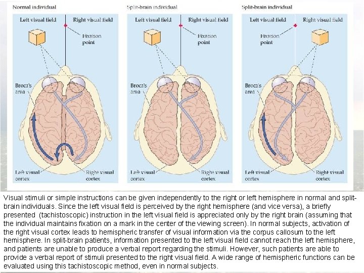 Visual stimuli or simple instructions can be given independently to the right or left