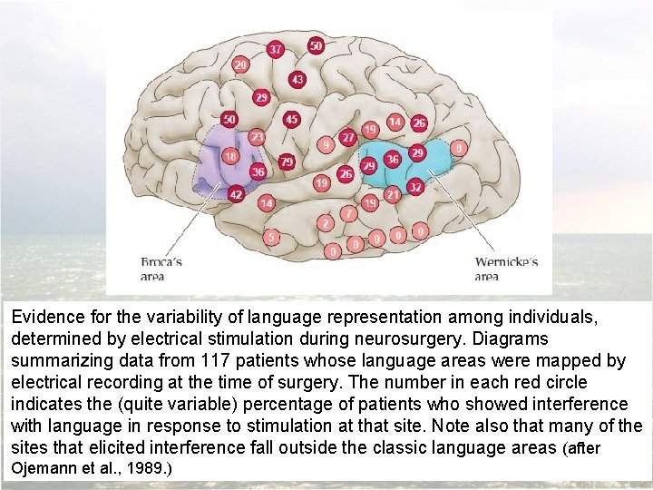 Evidence for the variability of language representation among individuals, determined by electrical stimulation during