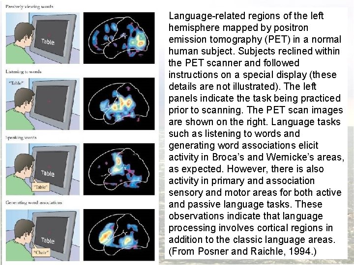 Language-related regions of the left hemisphere mapped by positron emission tomography (PET) in a
