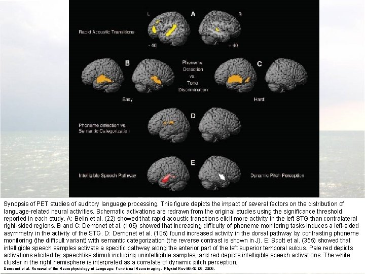 Synopsis of PET studies of auditory language processing. This figure depicts the impact of