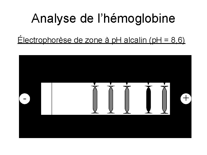 Analyse de l’hémoglobine Électrophorèse de zone à p. H alcalin (p. H = 8,