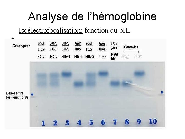 Analyse de l’hémoglobine Isoélectrofocalisation: fonction du p. Hi • 