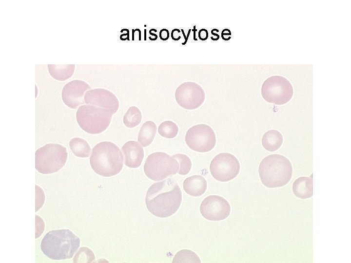 HEMOGLOBINE Physiologie Hmolyse Globules Rouges PRINCIPAUX CONSTITUANTS DU