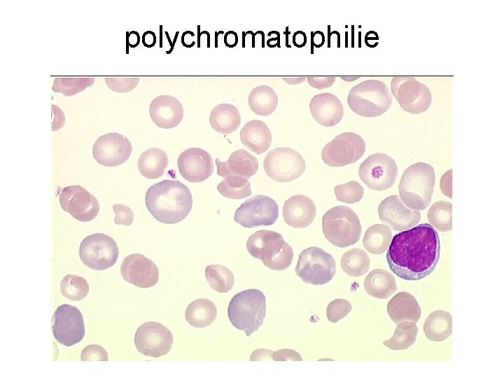 polychromatophilie 