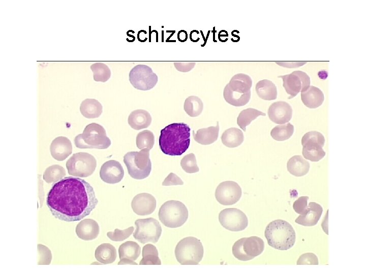 schizocytes 