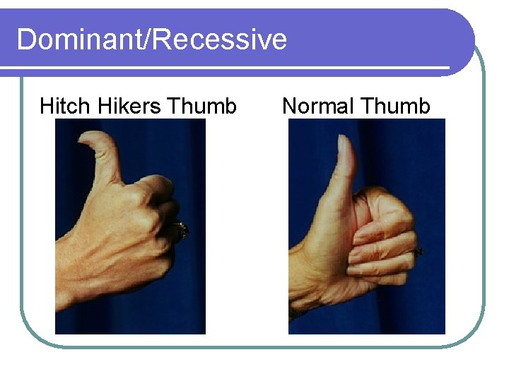 Dominant/Recessive Hitch Hikers Thumb Normal Thumb 