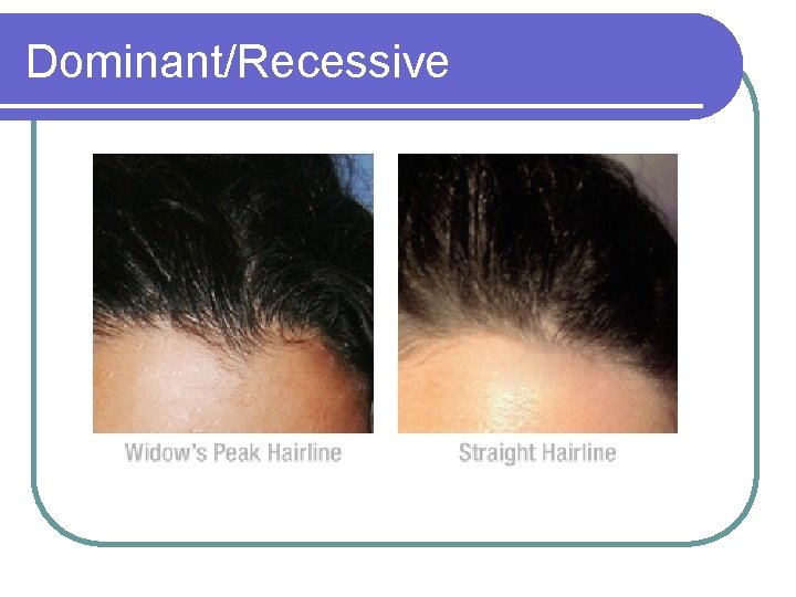 Dominant/Recessive 