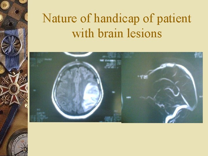 Nature of handicap of patient with brain lesions 