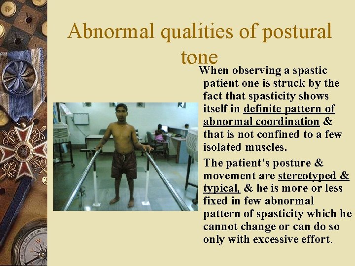 Abnormal qualities of postural tone When observing a spastic patient one is struck by