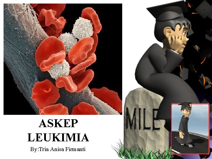 ASKEP LEUKIMIA By: Tria Anisa Firmanti 