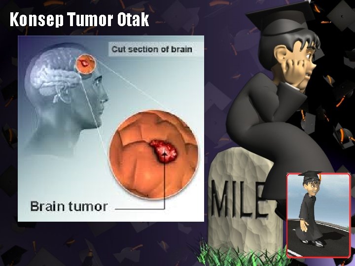 Konsep Tumor Otak 