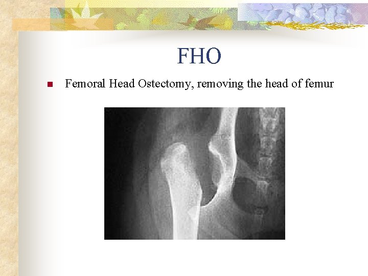 FHO n Femoral Head Ostectomy, removing the head of femur 