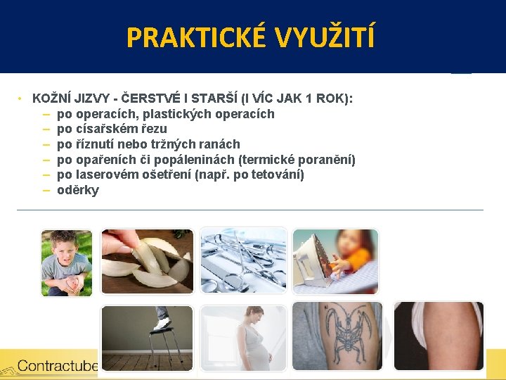 PRAKTICKÉ VYUŽITÍ • KOŽNÍ JIZVY - ČERSTVÉ I STARŠÍ (I VÍC JAK 1 ROK):