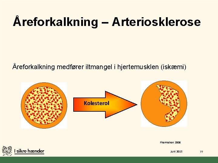 Åreforkalkning – Arteriosklerose Åreforkalkning medfører iltmangel i hjertemusklen (iskæmi) Kolesterol Pharmakon 2008 Juni 2015