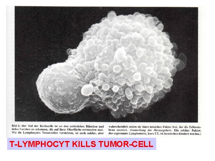 T-LYMPHOCYT KILLS TUMOR-CELL 