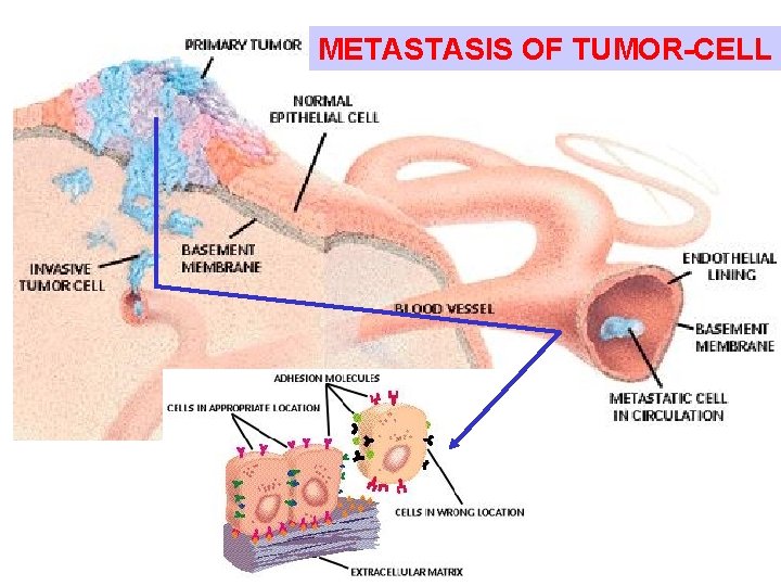 METASTASIS OF TUMOR-CELL 