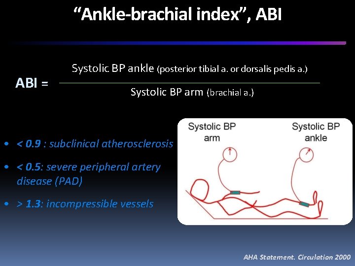 “Ankle-brachial index”, ABI = Systolic BP ankle (posterior tibial a. or dorsalis pedis a.