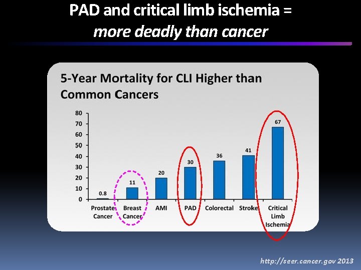 PAD and critical limb ischemia = more deadly than cancer http: //seer. cancer. gov